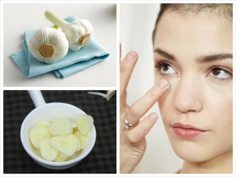 Mách nhỏ nàng các cách trị mụn trứng cá tại nhà cấp tốc 1
