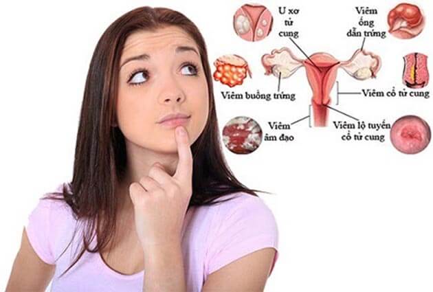 Cách ngăn ngừa bệnh phụ khoa trong tầm tay của bạn 1