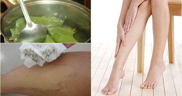 Triệt lông tại nhà đã không còn là điều quá khó 2