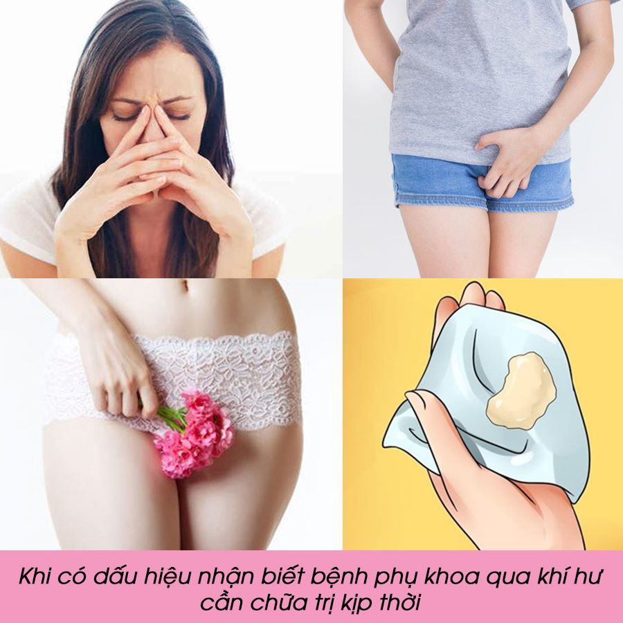 Dấu hiệu nhận biết bệnh phụ khoa chính xác nhất 3