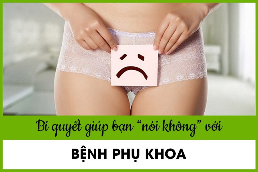 Cách ngăn ngừa bệnh phụ khoa trong tầm tay của bạn 2