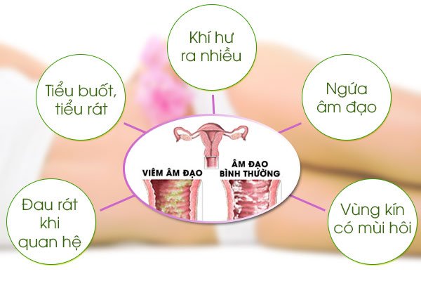 Dấu hiệu nhận biết bệnh phụ khoa chính xác nhất 2