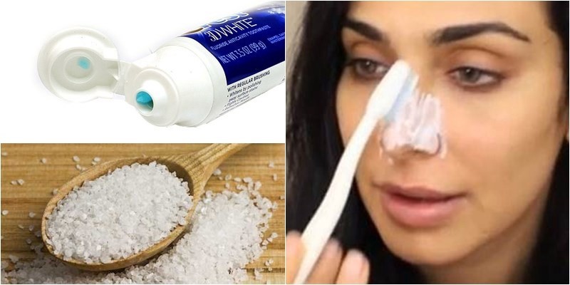 Trị mụn bằng kem đánh răng có hiệu quả hay không? 2