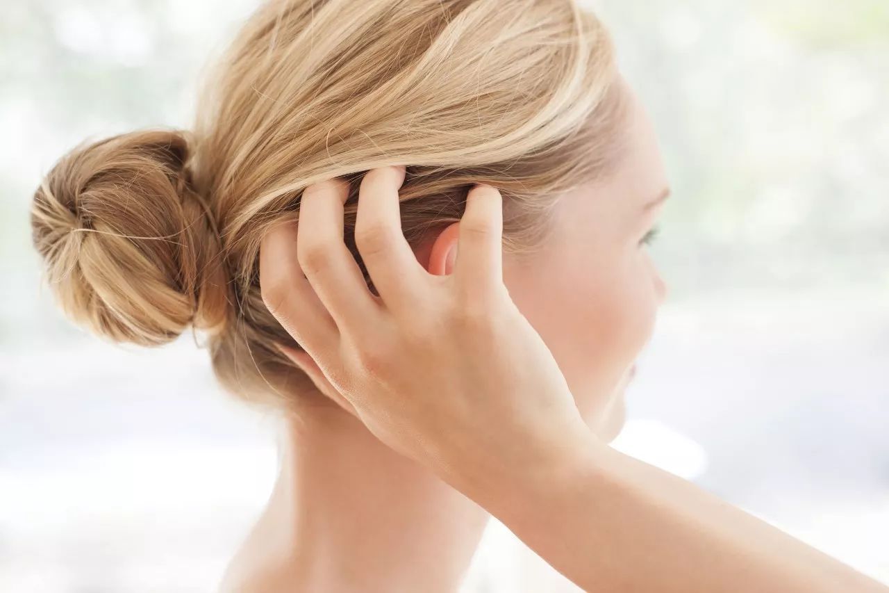 Đâu là nguyên nhân và cách trị gàu dứt điểm nhanh nhất? 2