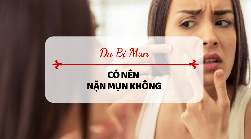Bạn đã biết cách nặn mụn đúng cách chưa? 1