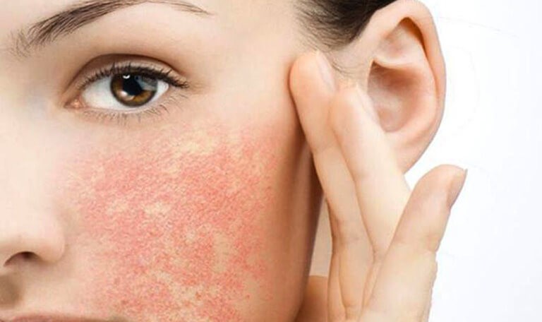 Những dấu hiệu cho thấy bạn dùng mỹ phẩm không hợp 3
