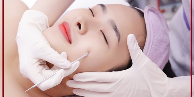Điểm danh các biện pháp trị mụn dứt điểm cho nàng 1