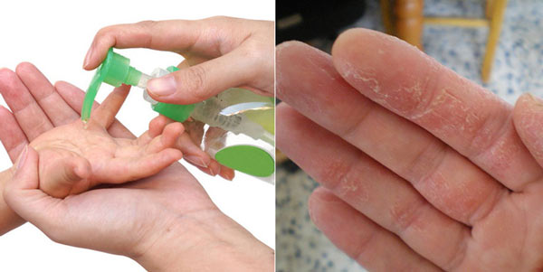 Có nên dùng gel rửa tay khô cho trẻ em hay không? 1