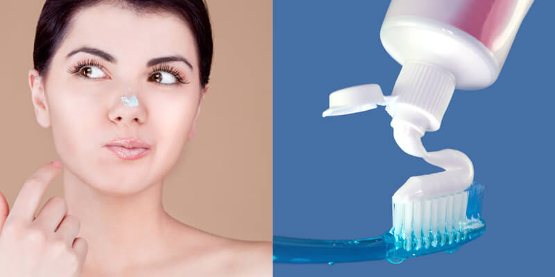 Trị mụn bằng kem đánh răng có hiệu quả hay không? 1