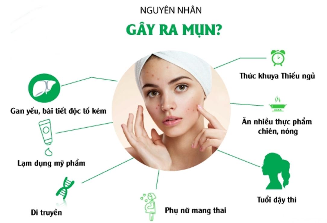 Những lời khuyên cho da mụn rất tiếc nếu bạn không biết 2