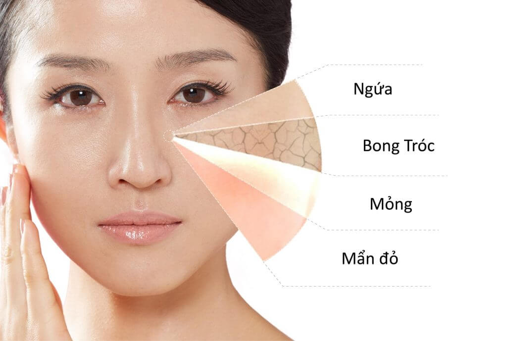 Những lưu ý khi chăm sóc da mùa hè dành cho nàng 1