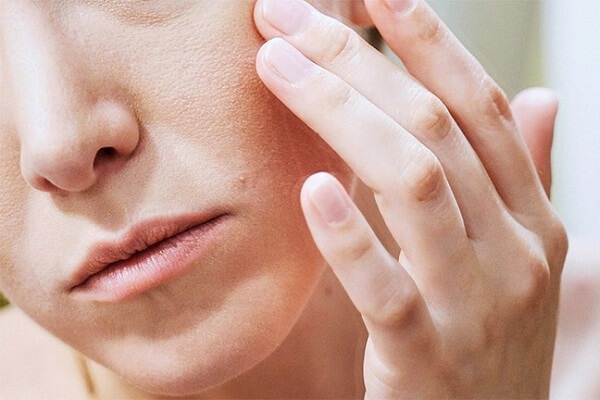 5 vấn đề về da thường gặp nhất vào mùa hè 3