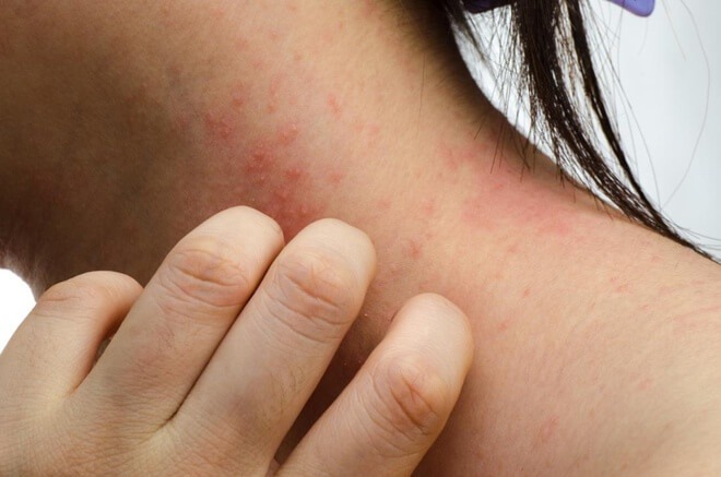  Những điều đáng sợ về thuốc nhuộm mà bạn chưa biết 3