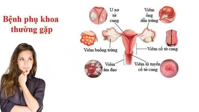 Top các bệnh phụ khoa thường gặp nhất 2