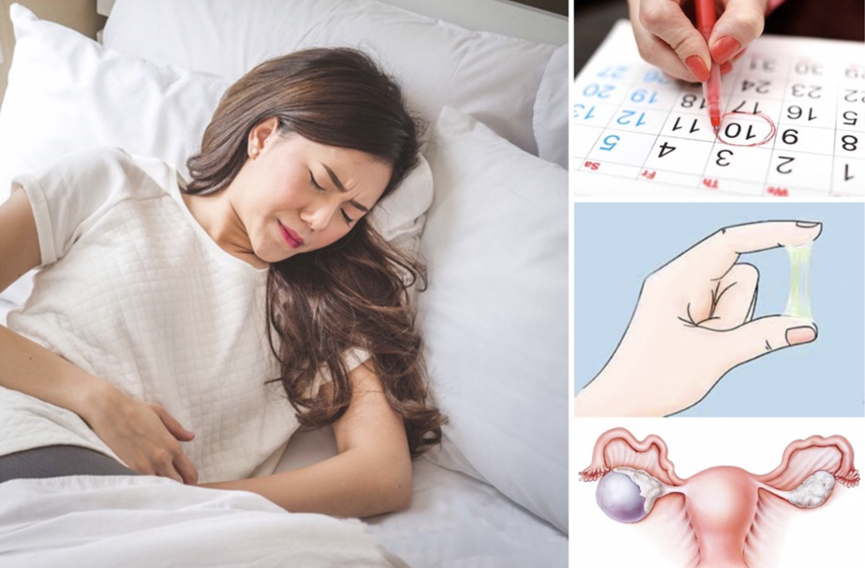 5 bệnh phụ khoa thường gặp ở phụ nữ