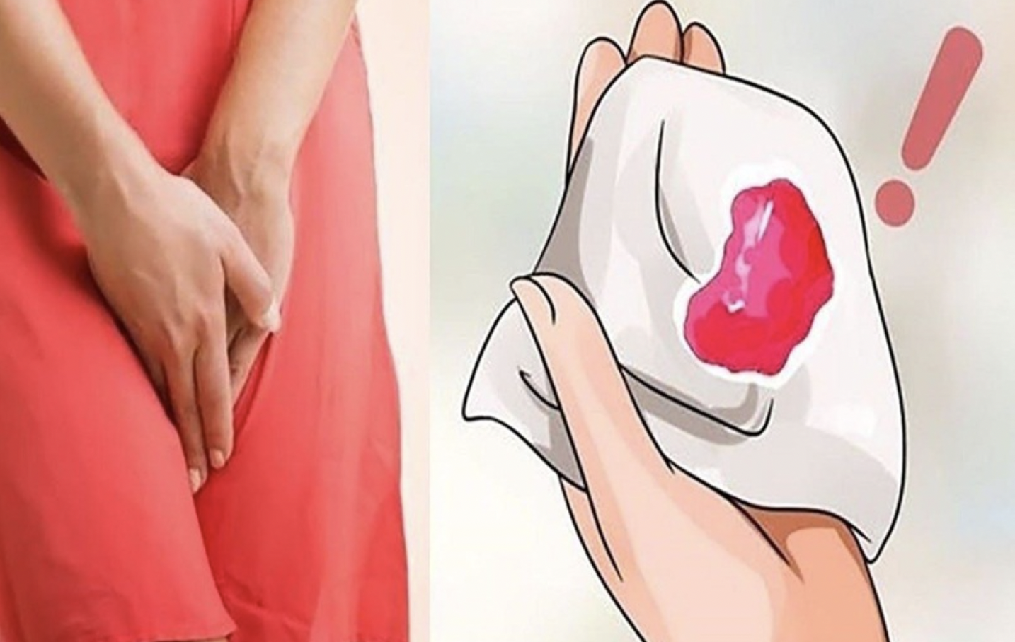 Chảy máu âm đạo trong tam cá nguyệt đầu tiên