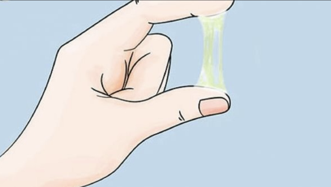 Làm gì khi âm đạo tiết dịch nhiều bất thường?