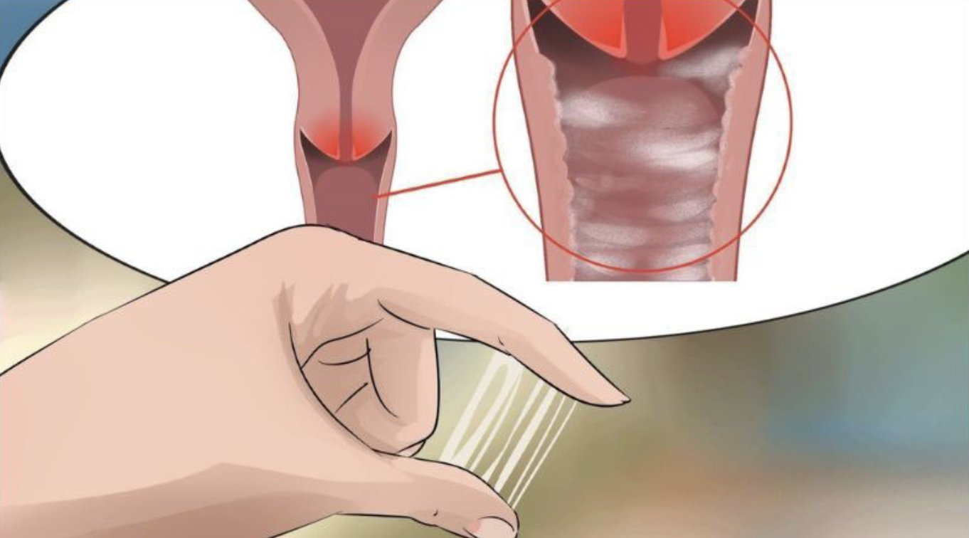 Điều trị ngay nếu vùng kín có bất thường.