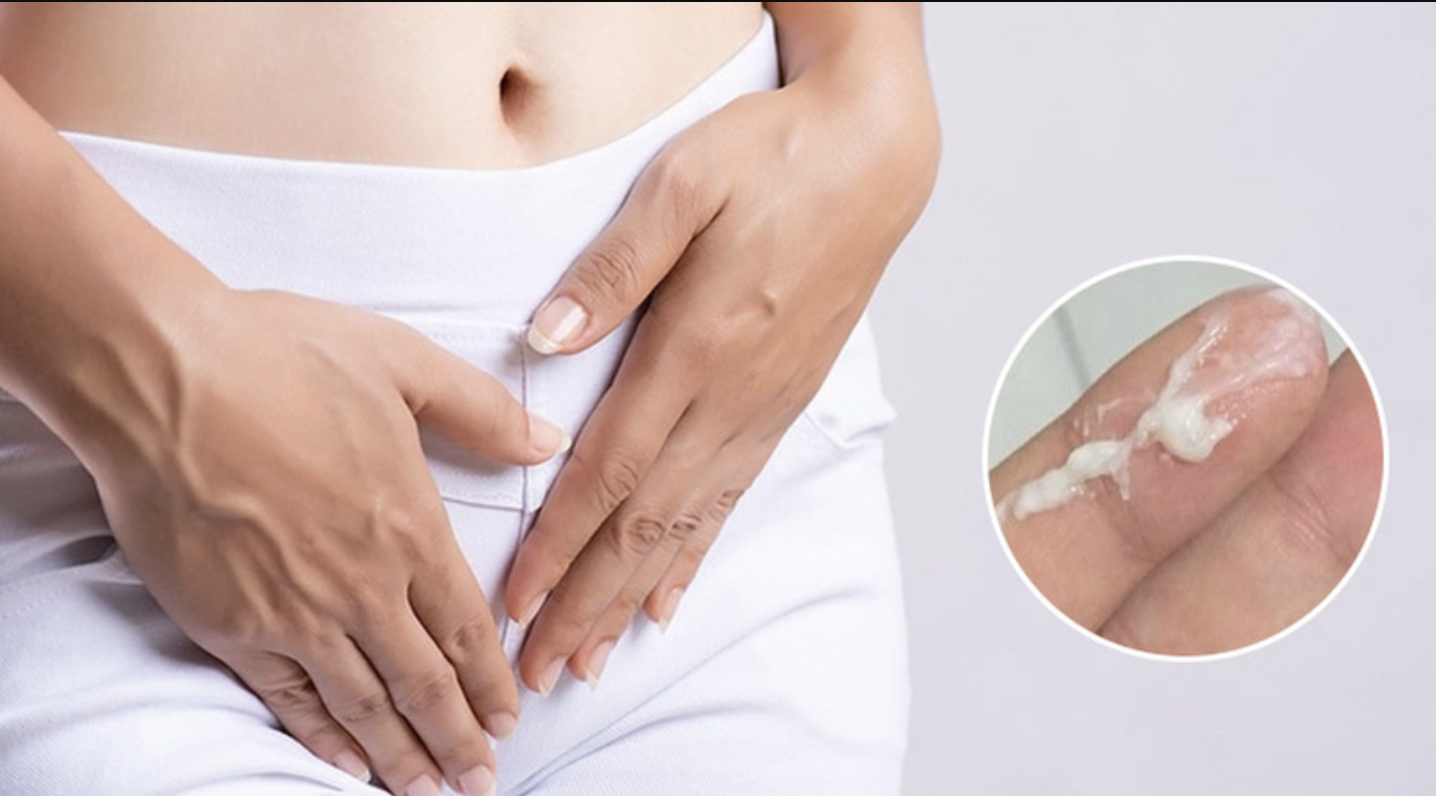 Vùng kín có mảng bám màu trắng là tình trạng gì?