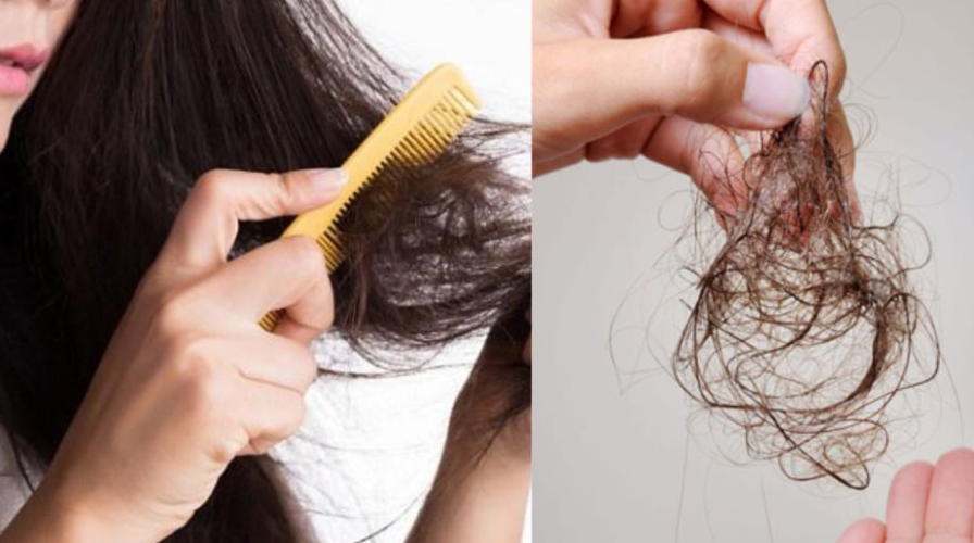 Chải tóc sai cách và không đúng dụng cụ làm tóc dễ gãy rụng hơn