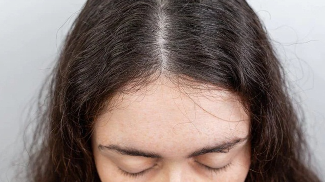 Tóc rễ tre là gì? Cách nhận biết
